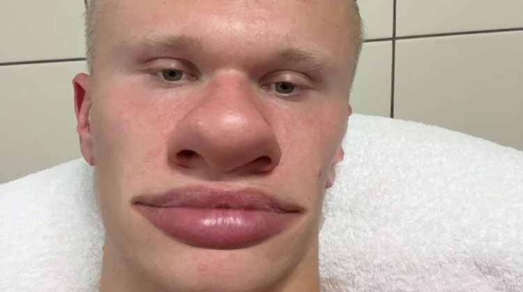 😂想到谁？哈兰德晒搞怪自拍，大鼻子👃+香肠嘴👄